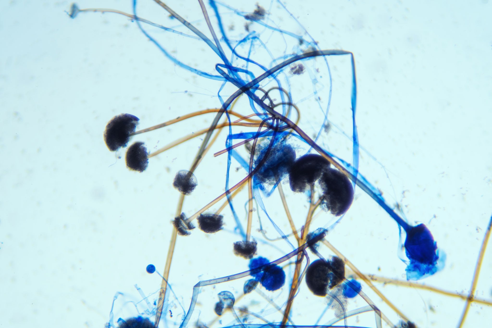 Rhizopus